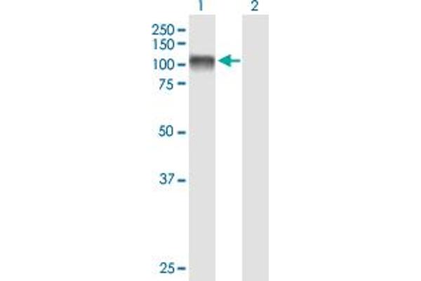 EEF2K antibody  (AA 1-725)