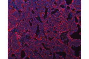 IF analysis of ATP5F1B using anti-ATP5F1B antibody (ABIN7599866). (Atp5f1b (AA 123-529) antibody)