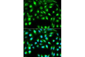 Immunofluorescence analysis of A549 cells using GEMIN2 antibody. (SIP1 antibody)