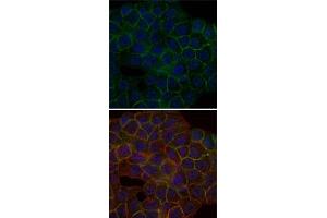 Immunofluorescence analysis of HepG2 cells using BLNK monoclonal antibody, clone 5G9  (green).