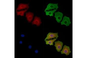 ABIN6258194 and ABIN6273898 staining Hela cells by IF/ICC.