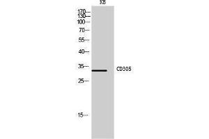 Western Blotting (WB) image for anti-Leukocyte-Associated Immunoglobulin-Like Receptor 1 (LAIR1) (Internal Region) antibody (ABIN3178980) (LAIR1 antibody  (Internal Region))