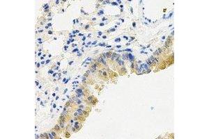 Immunohistochemistry (IHC) image for anti-Protein Kinase, CGMP-Dependent, Type I (PRKG1) antibody (ABIN7308230)