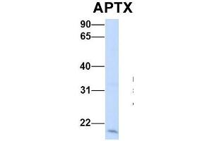 Host:  Rabbit  Target Name:  APTX  Sample Type:  Human 293T  Antibody Dilution:  1. (Aprataxin antibody  (Middle Region))