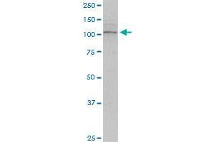 TRPV1 monoclonal antibody (M01), clone 1F5. (TRPV1 antibody  (AA 21-124))