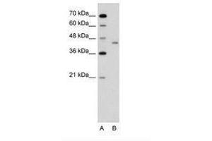 Image no. 1 for anti-LRP2 Binding Protein (LRP2BP) (AA 151-200) antibody (ABIN6736640) (LRP2BP antibody  (AA 151-200))