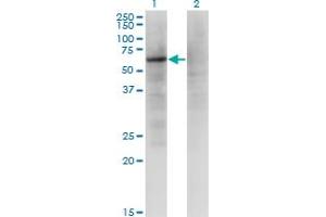 Western Blot analysis of ZNF34 expression in transfected 293T cell line by ZNF34 monoclonal antibody (M03), clone 1B11. (ZNF34 antibody  (AA 104-203))