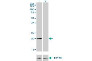 Western blot analysis of CSRP3 over-expressed 293 cell line, cotransfected with CSRP3 Validated Chimera RNAi (Lane 2) or non-transfected control (Lane 1). (CSRP3 antibody  (AA 95-194))