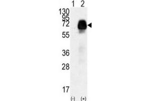 Western Blotting (WB) image for anti-Anti-Mullerian Hormone Receptor, Type II (AMHR2) antibody (ABIN3002999)
