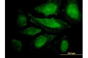 Immunofluorescence of purified MaxPab antibody to CABLES1 on HeLa cell. (CABLES1 antibody  (AA 1-368))