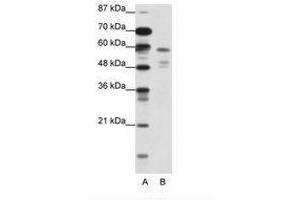 Image no. 1 for anti-Nuclear Receptor Subfamily 1, Group H, Member 3 (NR1H3) (N-Term) antibody (ABIN202546) (NR1H3 antibody  (N-Term))