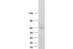 Western Blotting (WB) image for Nudix (Nucleoside Diphosphate Linked Moiety X)-Type Motif 19 (NUDT19) protein (Myc-DYKDDDDK Tag) (ABIN2727756)
