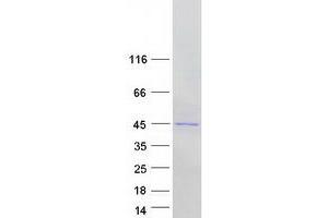 NUDT19 Protein (Myc-DYKDDDDK Tag)