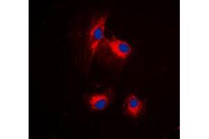 Immunofluorescent analysis of MRPL15 staining in HuvEc cells. (MRPL15 antibody  (Center))