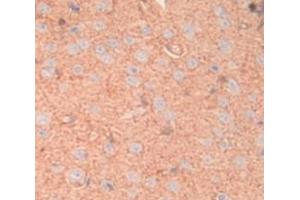 IHC-P analysis of Rat Tissue, with DAB staining. (MGP antibody  (AA 20-103))