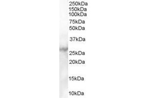 ABIN185321 (1µg/ml) staining of Human Heart lysate (35µg protein in RIPA buffer). (MBL2 antibody  (C-Term))