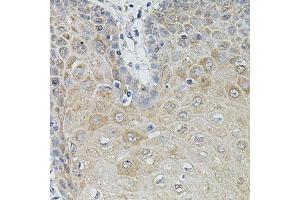 Immunohistochemistry of paraffin-embedded human esophagus using MMP9 antibody (ABIN5998248) at dilution of 1/100 (40x lens). (MMP 9 antibody)