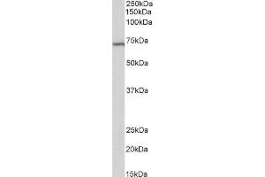 ABIN2613488 (2µg/ml) staining of Daudi lysate (35µg protein in RIPA buffer). (TICAM1 antibody  (Internal Region))