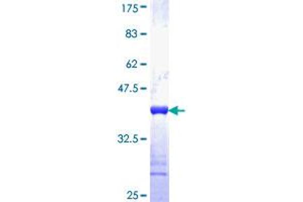 SLMAP Protein (AA 677-784) (GST tag)