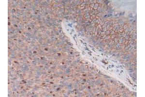 Figure. (S100A14 antibody  (AA 1-91))