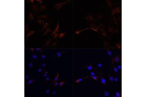 Immunofluorescence analysis of C6 cells using MAP1LC3B antibody (ABIN1876926) at dilution of 1:100.