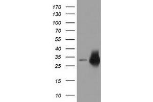 HEK293T cells were transfected with the pCMV6-ENTRY control (Left lane) or pCMV6-ENTRY CRYM (Right lane) cDNA for 48 hrs and lysed. (CRYM antibody)