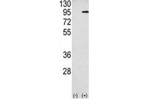 Western blot analysis APP antibody and 293 cell lysate (2 ug/lane) either nontransfected (Lane 1) or transiently transfected with the APP gene (2). (APP antibody  (AA 29-61))