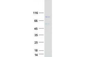 Western Blotting (WB) image for Adducin 2 (Beta) (ADD2) protein (Myc-DYKDDDDK Tag) (ABIN2715230)
