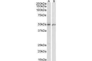 ABIN1686793 (1µg/ml) staining of Human lung (A) and Human Umbilical Cord (B) lysates (35µg protein in RIPA buffer). (ECSCR antibody  (C-Term))