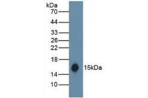 Detection of recombinant HB using Polyclonal Antibody to Hemoglobin (HB) (Hemoglobin antibody)