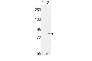 Western blot analysis of FGFR1 (arrow) using rabbit polyclonal FGFR1- (ABIN653771 and ABIN2843063). (FGFR1 antibody  (AA 285-314))