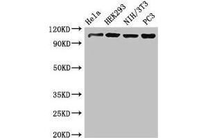 Western Blot Positive WB detected in: Hela whole cell lysate, HEK293 whole cell lysate, NIH/3T3 whole cell lysate, PC-3 whole cell lysate All lanes: NUP107 antibody at 3. (NUP17 (AA 1-66) antibody)
