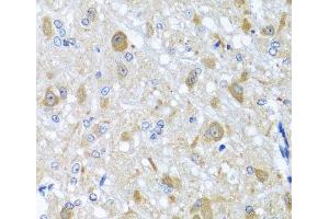 Immunohistochemistry of paraffin-embedded Rat brain using BNIP3L Polyclonal Antibody at dilution of 1:100 (40x lens). (BNIP3L/NIX antibody)