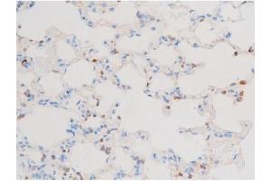 ABIN6267603 at 1/200 staining Rat lung tissue sections by IHC-P. (PKC theta antibody  (pSer676))