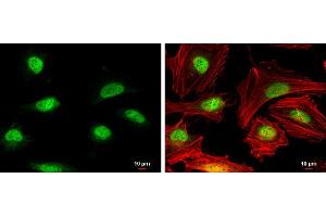 ICC/IF Image Rad51 antibody [N1C2] detects Rad51 protein at nucleus by immunofluorescent analysis. (RAD51 antibody  (Center))