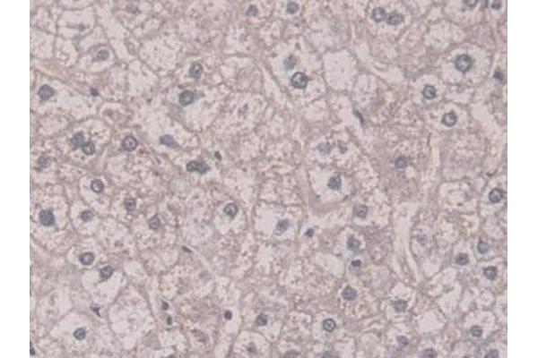 KIF18A antibody  (AA 1-453)