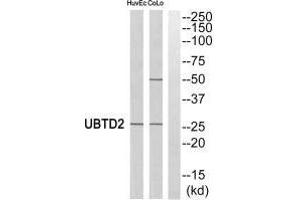 Western blot analysis of extracts from HuvEc cells and COLO cells, using UBTD2 antibody. (UBTD2 antibody  (C-Term))