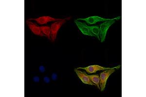 ABIN6264259 and ABIN6273065 staining Hela cells by IF/ICC.