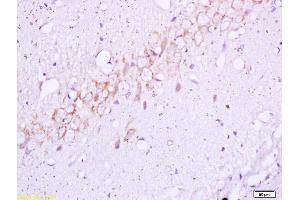 Formalin-fixed and paraffin embedded rat brain tissue labeled with Anti BETA(TYR1345) Polyclonal Antibody,Unconjugated (ABIN747128) at 1:200 followed by conjugation to the secondary antibody and DAB staining.