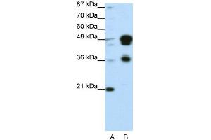 Western Blotting (WB) image for anti-Forkhead Box A1 (FOXA1) (C-Term) antibody (ABIN2779762)