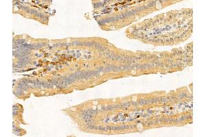 ABIN7094769 and ABIN7098820 at 1/100 staining Mouse stomach tissue by IHC-P. (PRMT3 antibody  (Internal Region))