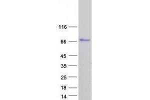 Validation with Western Blot (Calpastatin Protein (CAST) (Transcript Variant 3) (Myc-DYKDDDDK Tag))