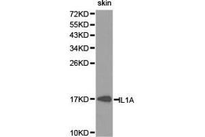 Western Blotting (WB) image for anti-Interleukin 1 alpha (IL1A) antibody (ABIN1873200) (IL1A antibody)