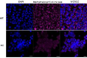 Immunocytochemical staining of HeLa cells using Methylmalonyl-CoA mutase antibody (ABIN7799396), 1:1,000), Top panel: wild-type (WT), Bottom panal: Methylmalonyl-CoA mutase shRNA knockdown (KD). (Recombinant MUT antibody)