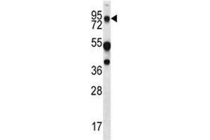 MUC20 antibody western blot analysis in WiDr lysate. (MUC20 antibody  (AA 654-684))