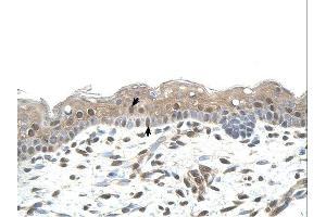 RNF25 antibody was used for immunohistochemistry at a concentration of 4-8 ug/ml. (RNF25 antibody  (Middle Region))