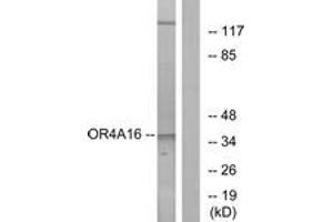 Western blot analysis of extracts from COLO cells, using OR4A16 Antibody. (OR4A16 antibody  (AA 261-310))
