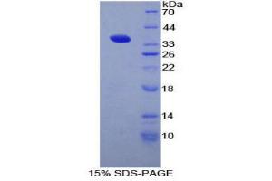 SDS-PAGE (SDS) image for CD1d Molecule (CD1D) (AA 32-302) protein (His tag) (ABIN2124369)