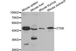 Western blot analysis of extracts of various cell lines, using CTSE antibody. (Cathepsin E antibody)