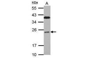 Image no. 2 for anti-B-Cell CLL/lymphoma 7C (BCL7C) (AA 1-215) antibody (ABIN1496855) (BCL7C antibody  (AA 1-215))